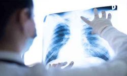 Yalova İl Sağlık Müdürlüğü: “Kasım Ayı Akciğer Kanseri Farkındalık Ayı – Erken Tanı Hayat Kurtarır”