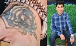 Dövme sildirmek isterken kabusu yaşadı, elindeki dokular öldü