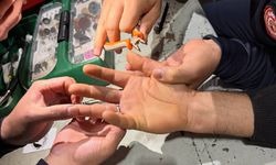 Gece Yarısı Panik: Parmağına Sıkışan Yüzük İtfaiye Tarafından Çıkarıldı