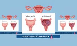 Yalova İl Sağlık Müdürlüğü’nden Serviks Kanseri İçin Ücretsiz Tarama Çağrısı