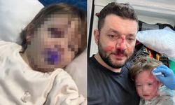 Yalova’da Baba Ve Kızına Scootterla Saldıran Sanığın Yargılanması Başladı