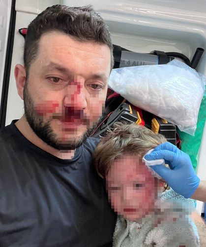 Yalova’da Saldırıya Uğrayan Babadan Teşekkür