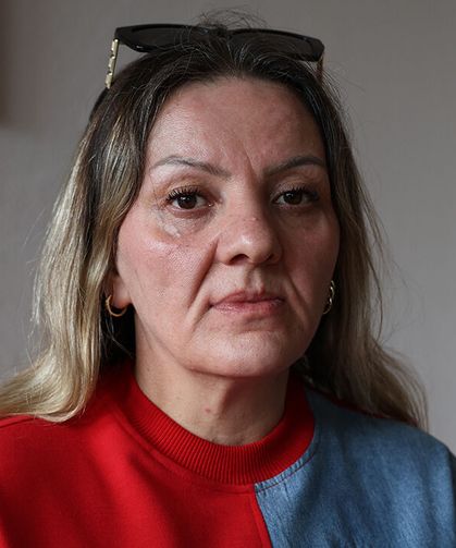 Diş Ağrısı Şikayetiyle Gitti 25 Dişinden Oldu