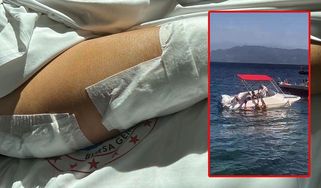 Yalova'da Sürat Teknesinin Çarptığı Yaşlı Kadın Ağır Yaralandı