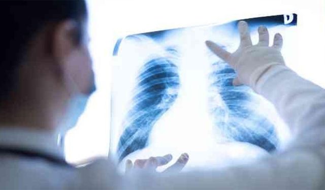 Yalova İl Sağlık Müdürlüğü: “Kasım Ayı Akciğer Kanseri Farkındalık Ayı – Erken Tanı Hayat Kurtarır”