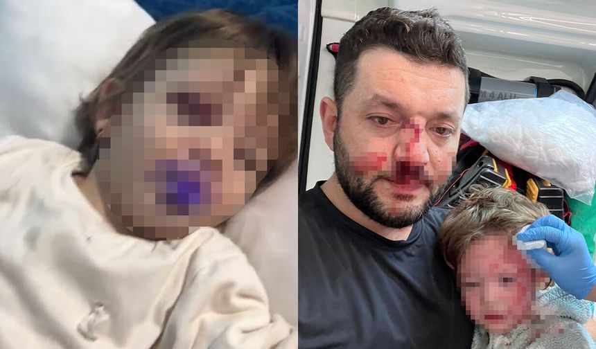 Yalova’da Baba Ve Kızına Scootterla Saldıran Sanığın Yargılanması Başladı