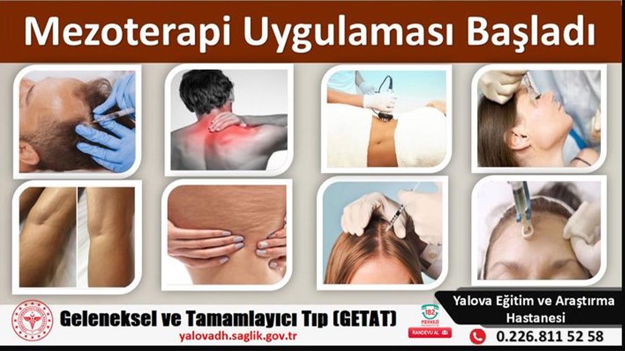 MEZOTERAPİ UYGULAMASI BAŞLADI