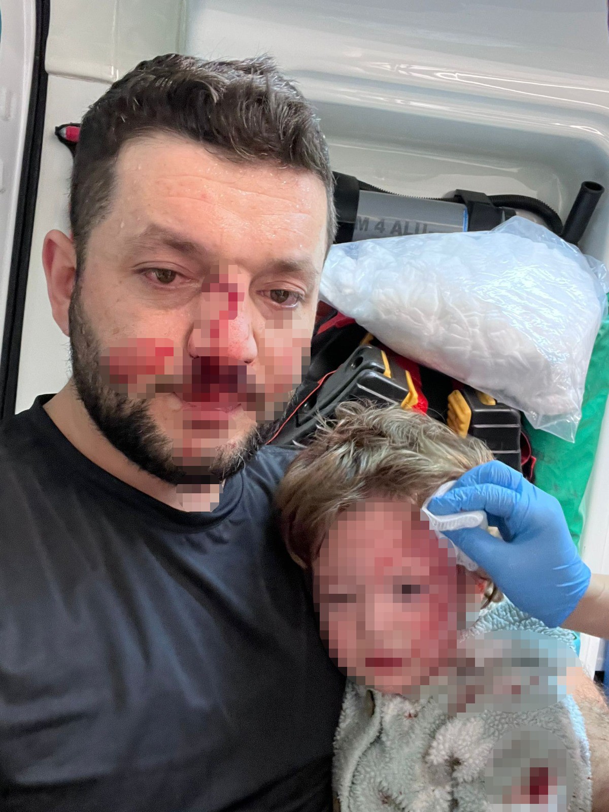 Yalova Esenkoy Komsu Kavga Baba Bebek Yarali (1)