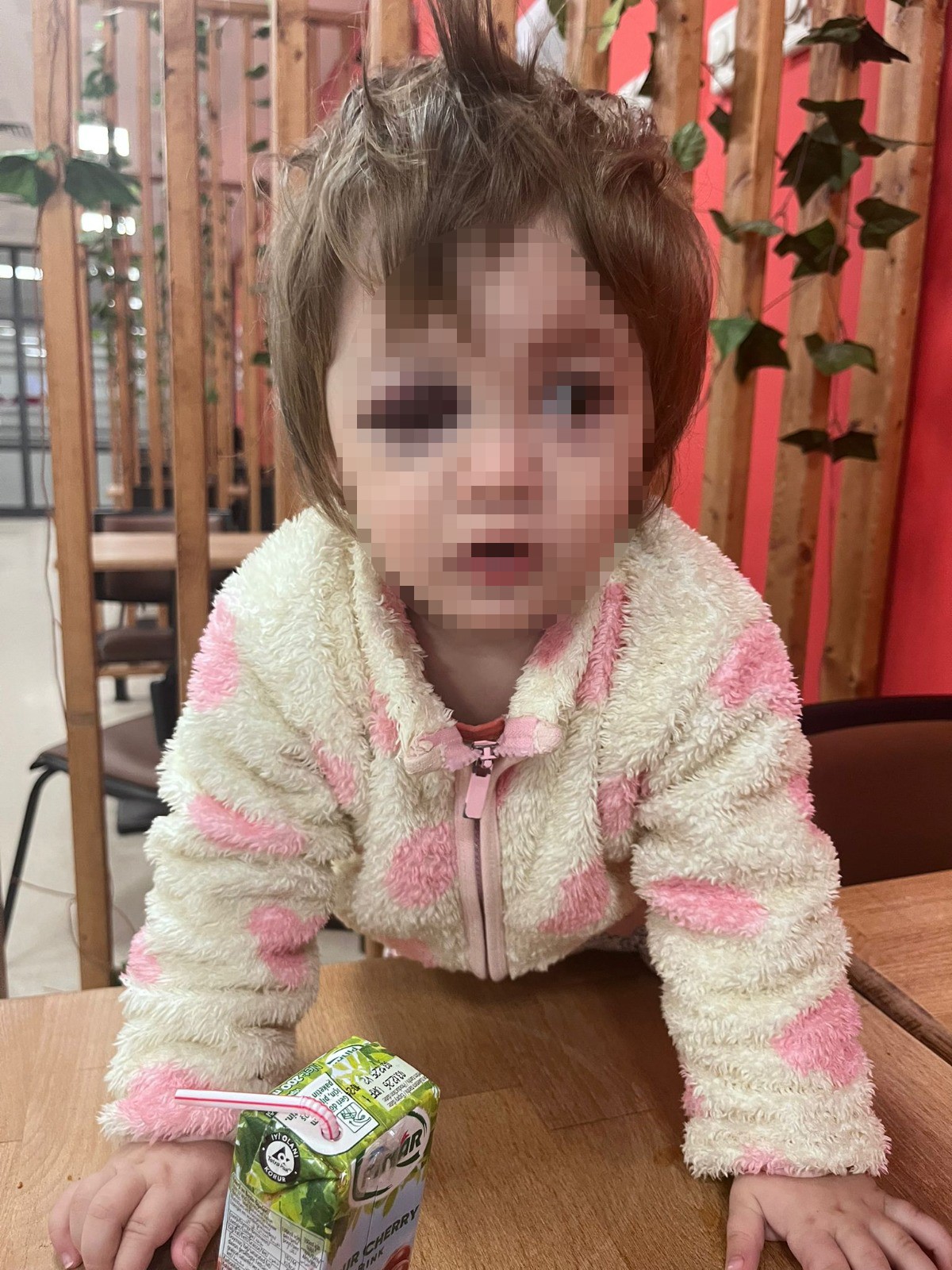 Yalova Esenkoy Komsu Kavga Baba Bebek Yarali (2)