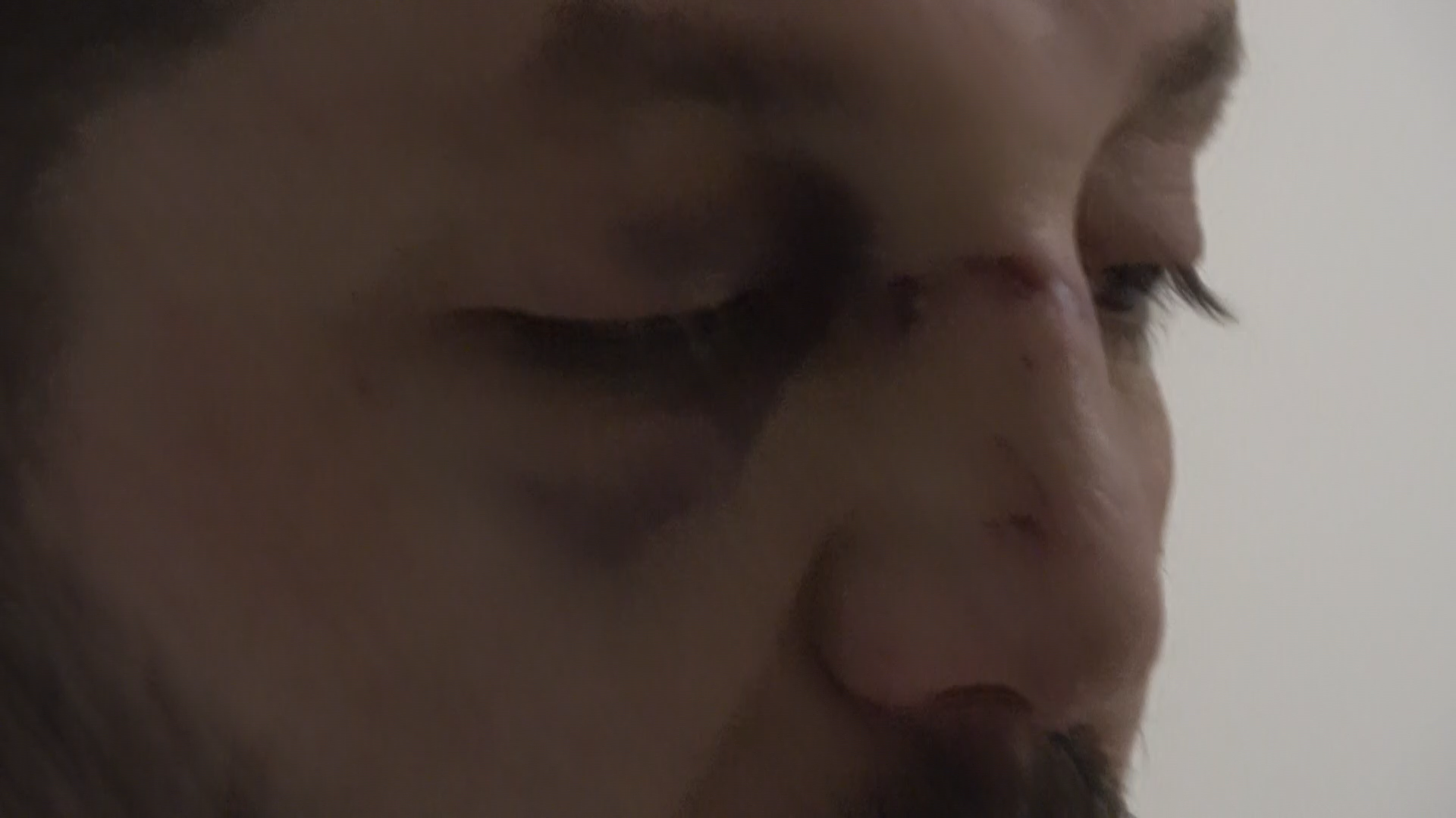 Yalova Esenkoy Komsu Kavga Baba Bebek Yarali (4)